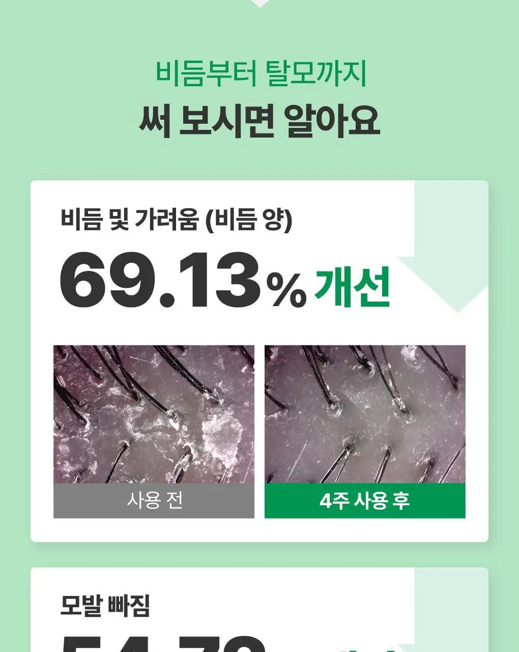 [지성 두피] 닥터방기원 댄드러프 샴푸 EX 탈모 케어 샴푸 (비듬/기름기 제거) 상세페이지 5